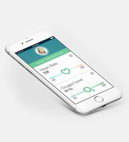 Owlet Smart Sock 2 Infant Heart Rate & Oxygen Monitor - BM03NNBBYC